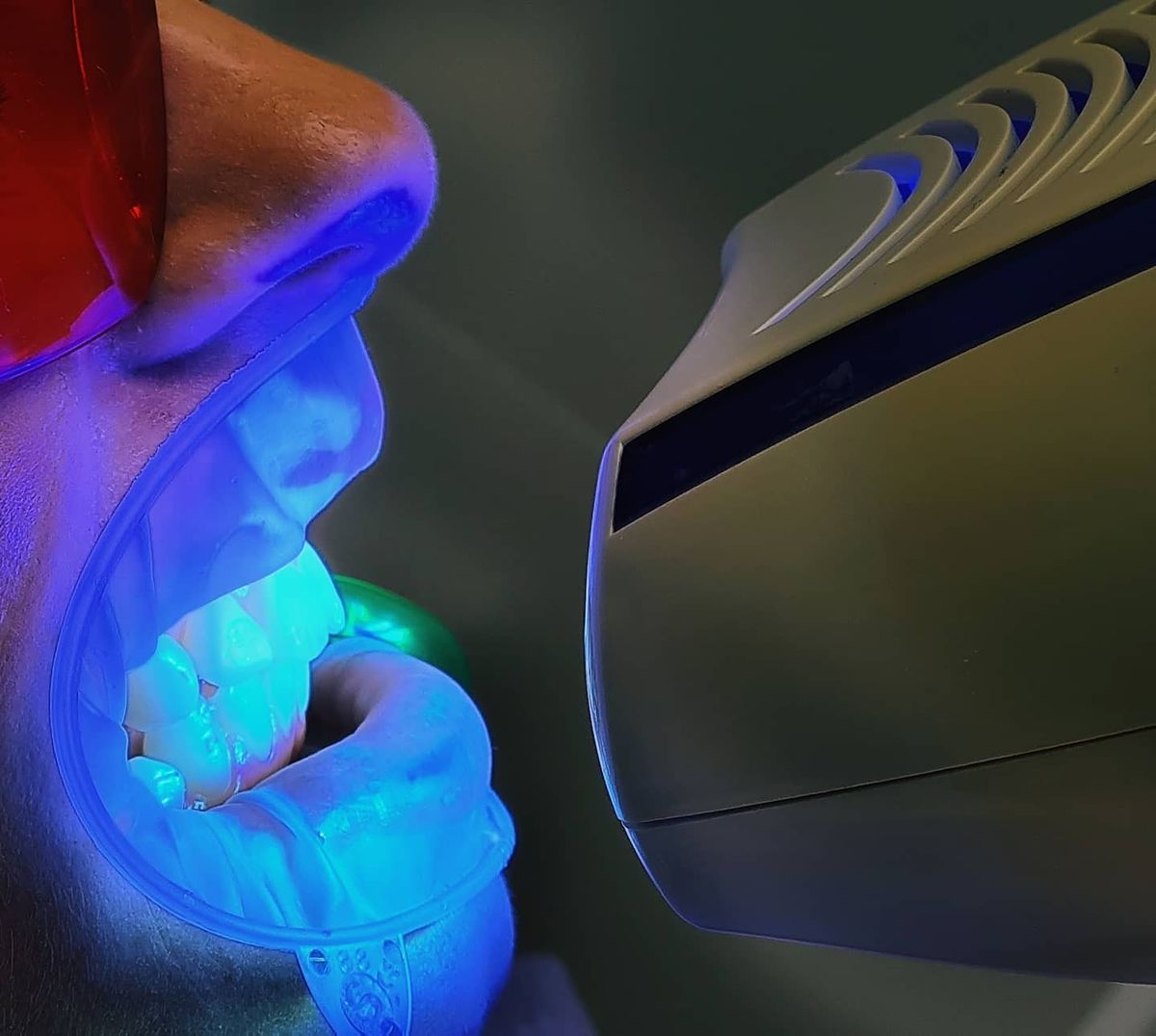 Teeth Whitening at EverSmile Dental Care
